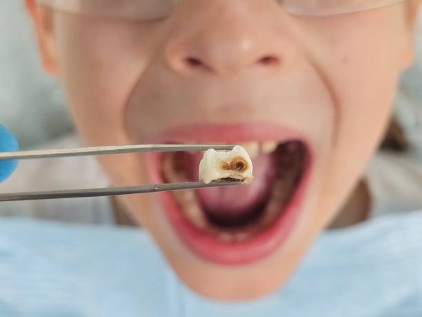 Best Pediatric Emergency Dentist in Remerton, GA