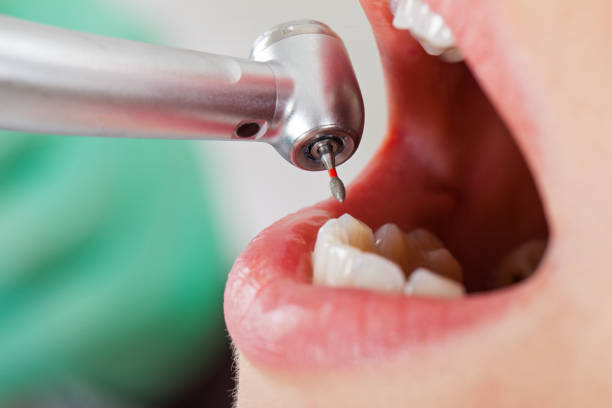 Best Orthodontic Emergency Dentist in Remerton, GA